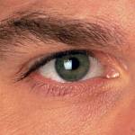 image of an eye